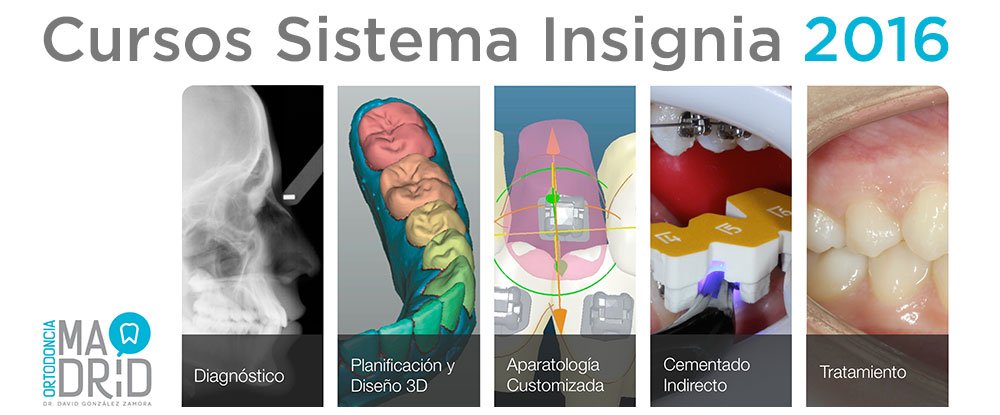 Ortodoncia Madrid - Curso del Sistema Insignia 2016