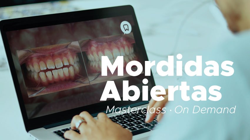 masterclass-mordidas-abiertas