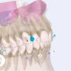 estudio-ortodoncia-invisible